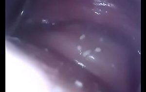 Fodendo o cú da puta e filmando com o endoscópio dentro da buceta arrombada com o epéculo vaginal