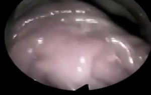 Video internal vagina